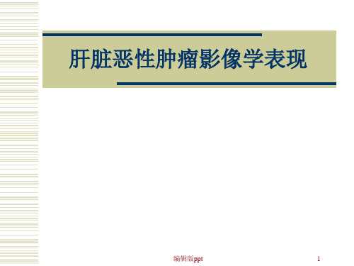 CT肝脏恶性肿瘤ppt课件