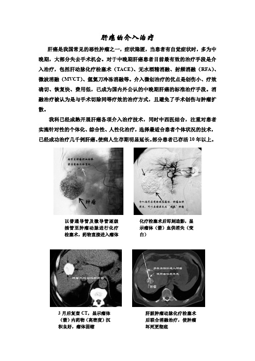 2肝肿瘤微创介入治疗