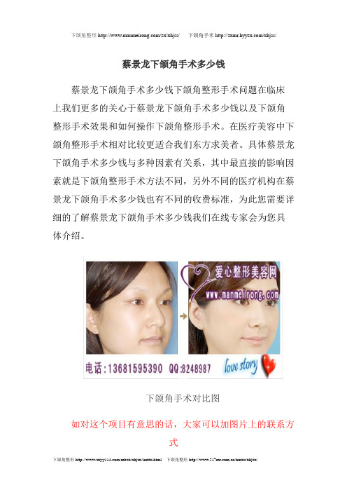 蔡景龙下颌角手术多少钱 整形168网