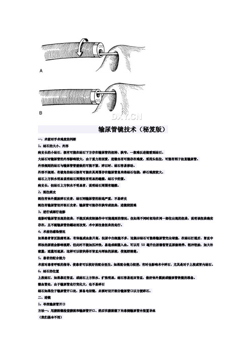输尿管镜技术(秘笈版)