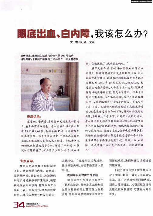 眼底出血、白内障,我该怎么办？