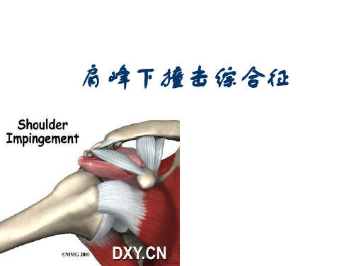 肩峰下撞击综合征再次修改课件.ppt