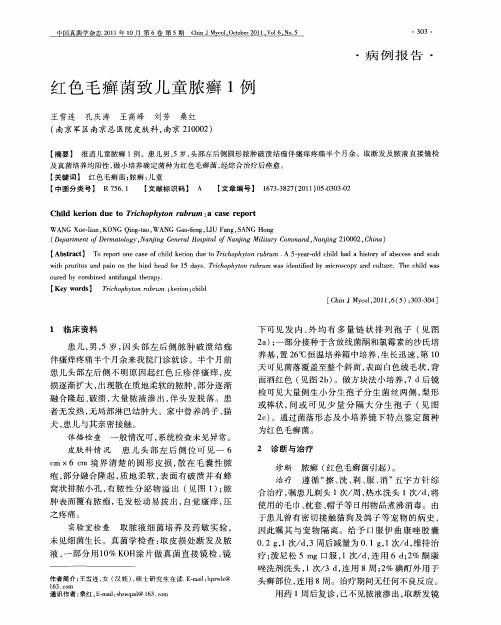 红色毛癣菌致儿童脓癣1例