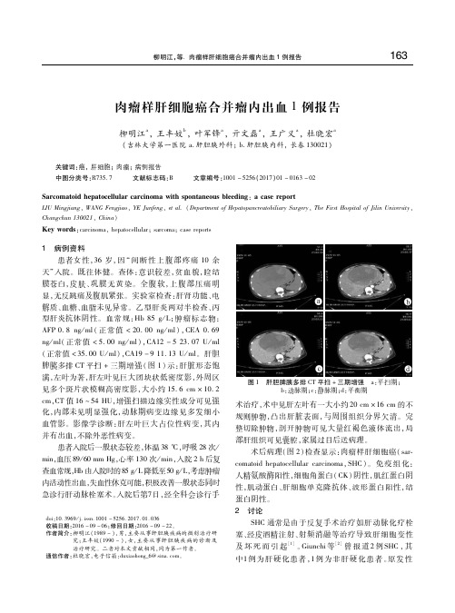 肉瘤样肝细胞癌合并瘤内出血1例报告 柳明江
