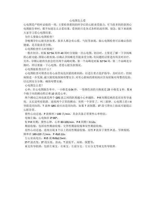 心电图怎么看