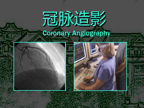 冠状动脉造影培训课件