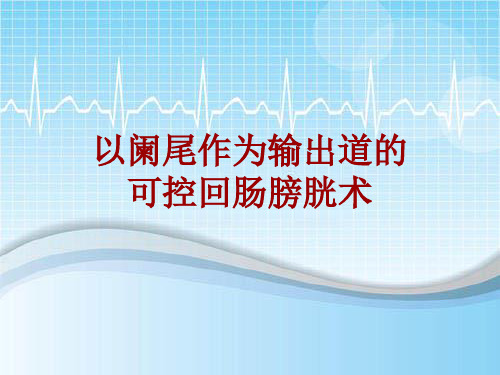 手术讲解模板：以阑尾作为输出道的可控回肠膀胱术