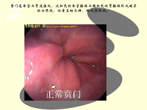 正常胃肠镜图片