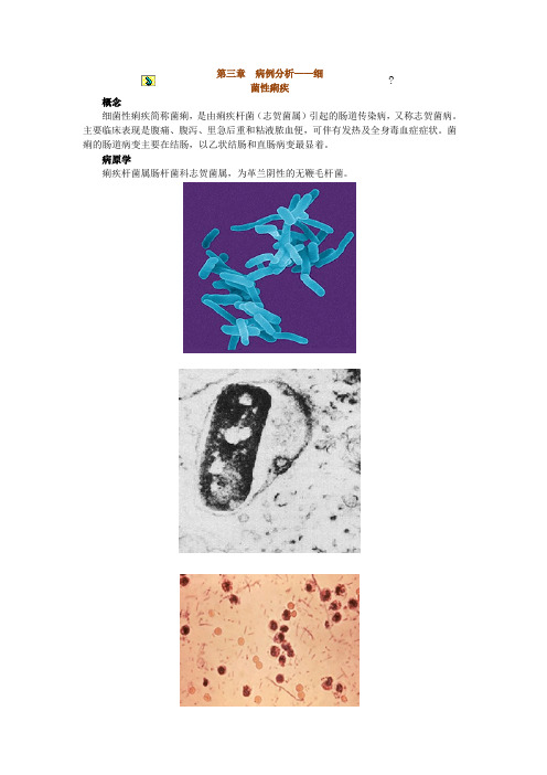 病例分析 细菌性痢疾