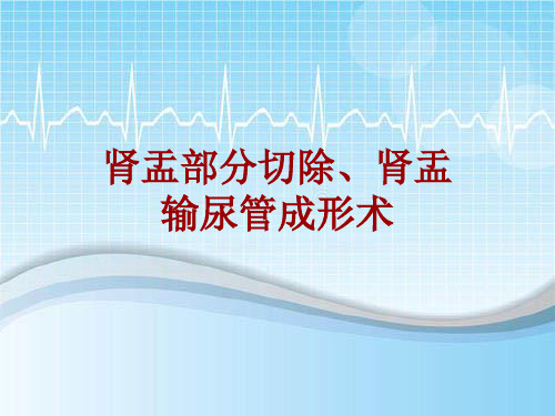 手术讲解模板：肾盂部分切除、肾盂输尿管成形术
