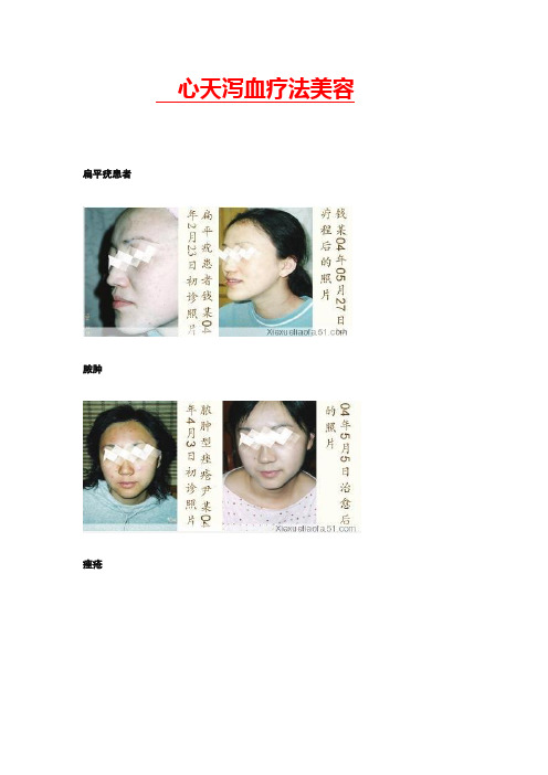 心天泻血疗法美容