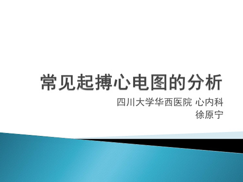 常见起搏心电图的分析