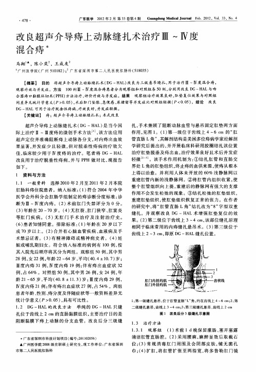 改良超声介导痔上动脉缝扎术治疗Ⅲ～Ⅳ度混合痔