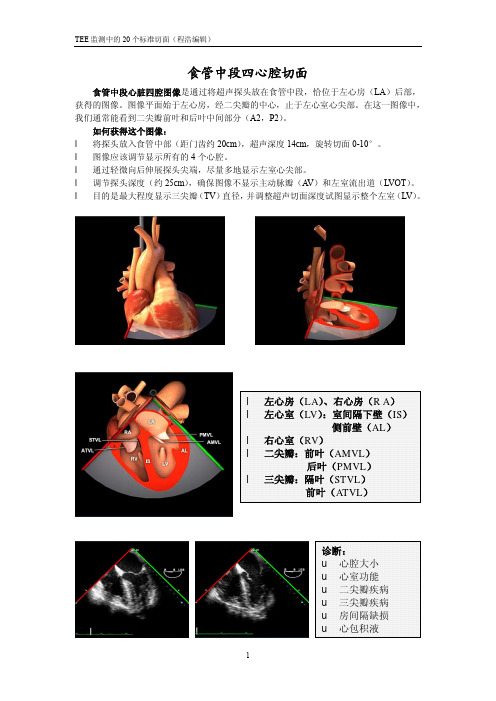 (仅供参考)TEE监测中的20个标准切面