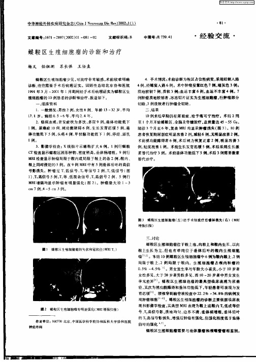 蝶鞍区生殖细胞瘤的诊断和治疗