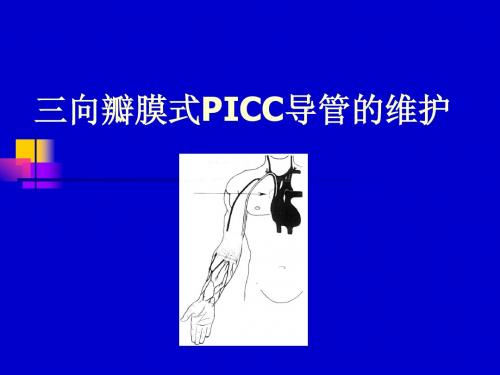 黄汝梁：三向瓣膜式PICC导管的维护