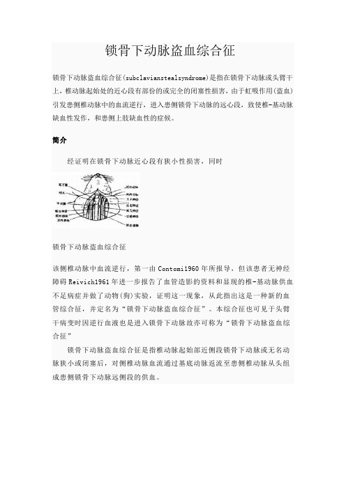锁骨下动脉盗血