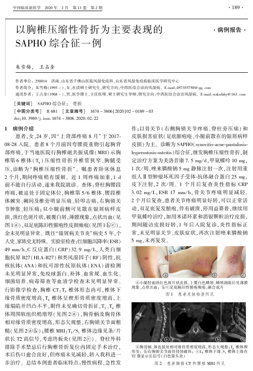 以胸椎压缩性骨折为主要表现的sapho综合征一例