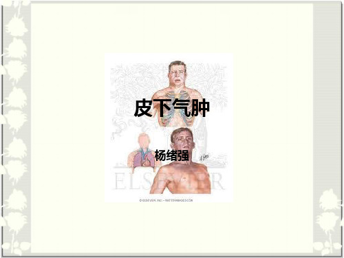 皮下气肿