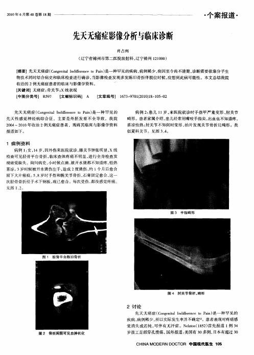 先天无痛症影像分析与临床诊断