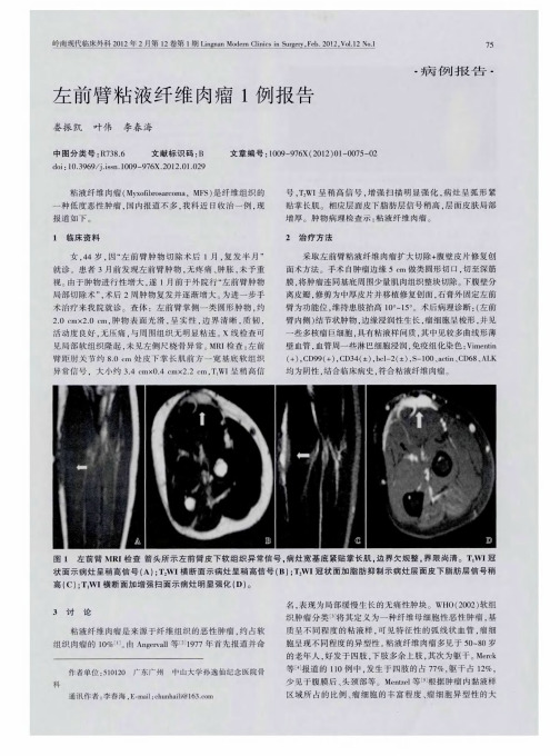 左前臂粘液纤维肉瘤1例报告