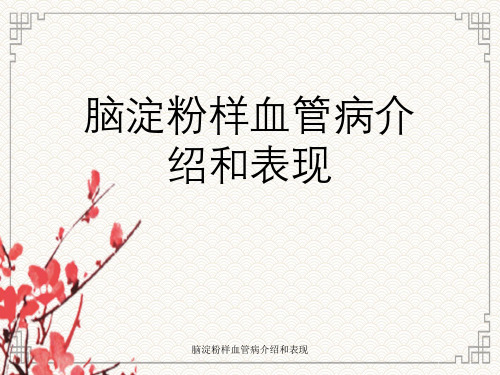 脑淀粉样血管病介绍与表现