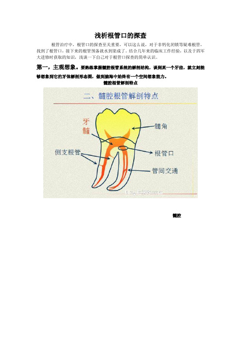 根管口的探查(开髓图)