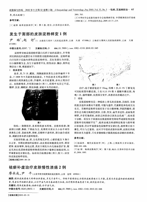 发生于面部的皮肤淀粉样变1例