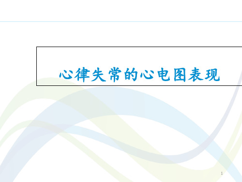 常见心律失常的心电图表现  ppt课件