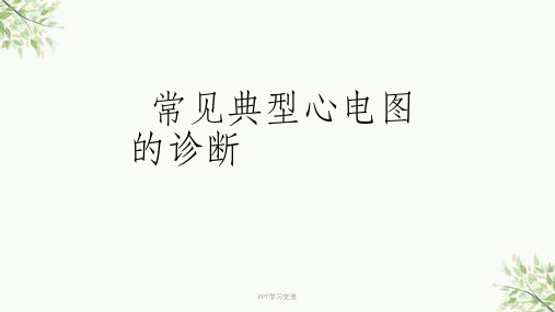 常见典型心电图诊断-规培课件