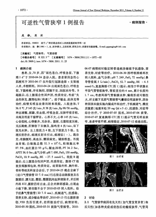 可逆性气管狭窄1例报告