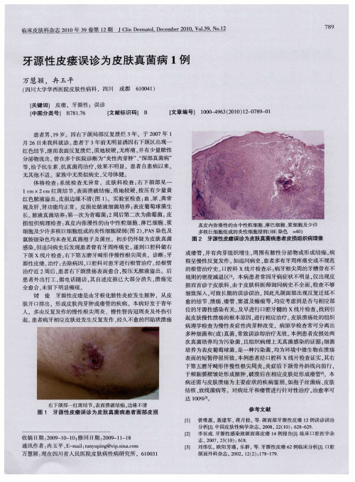 牙源性皮瘘误诊为皮肤真菌病1例