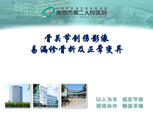 骨关节创伤易漏诊骨折及正常变异