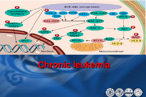 内科学英文课件：Chronic leukemia