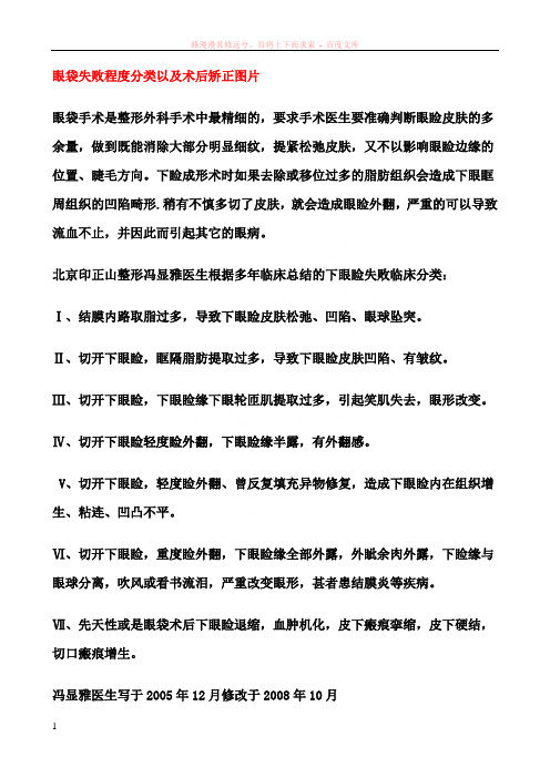 眼袋失败程度分类以及术后矫正图片