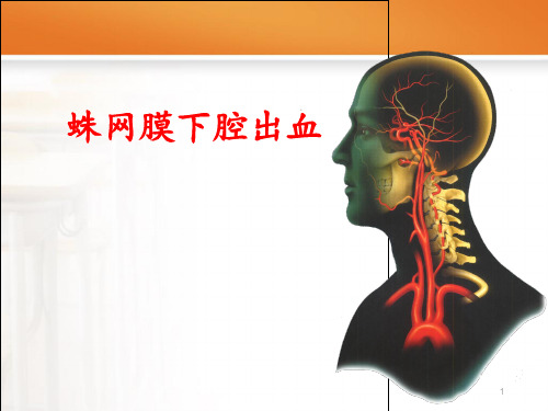 蛛网膜下腔出血【神经内科】  ppt课件
