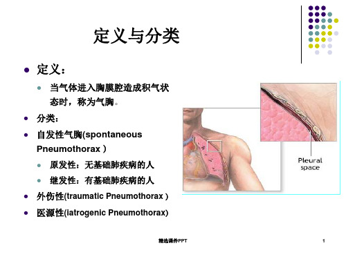 气胸的临床表现PPT课件