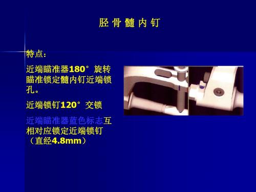 胫骨髓内钉课件
