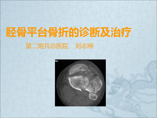 胫骨平台骨折的诊断及治疗ppt课件