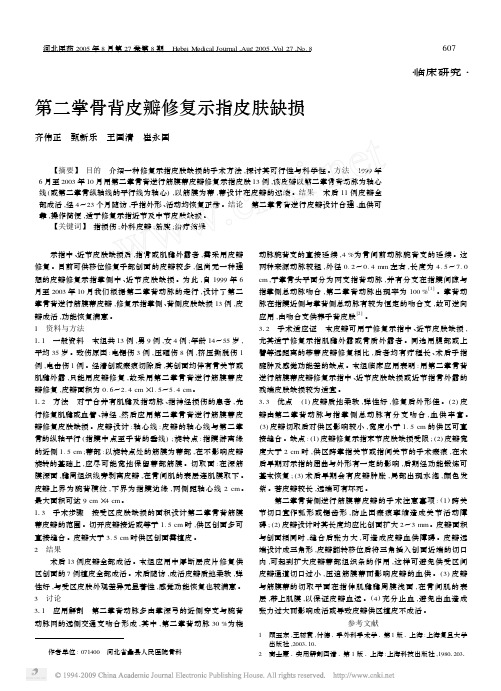 第二掌骨背皮瓣修复示指皮肤缺损