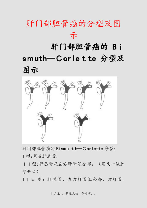 肝门部胆管癌的分型及图示(干货)
