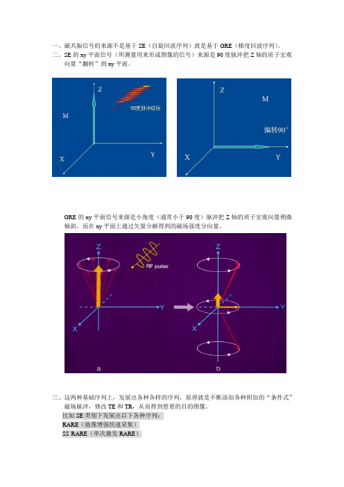 EPI与DWI和DTI分析2