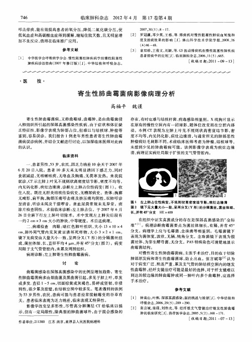 寄生性肺曲霉菌病影像病理分析
