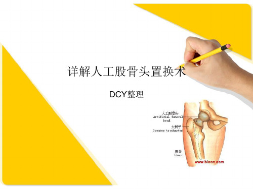 详解人工股骨头置换术