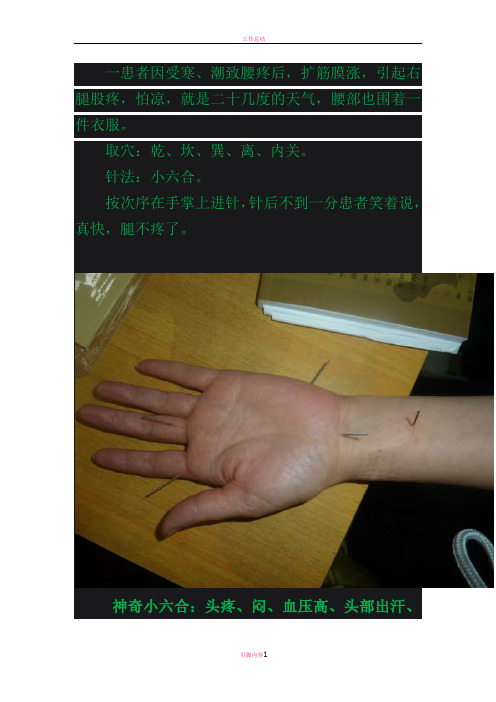 神奇小六合针灸法