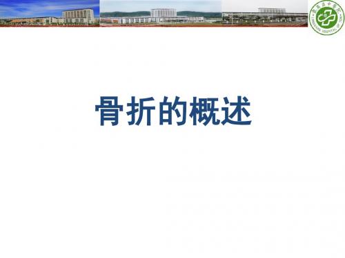 骨折的概述