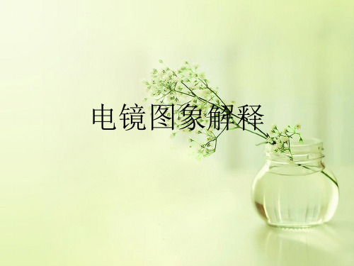 电镜图象解释