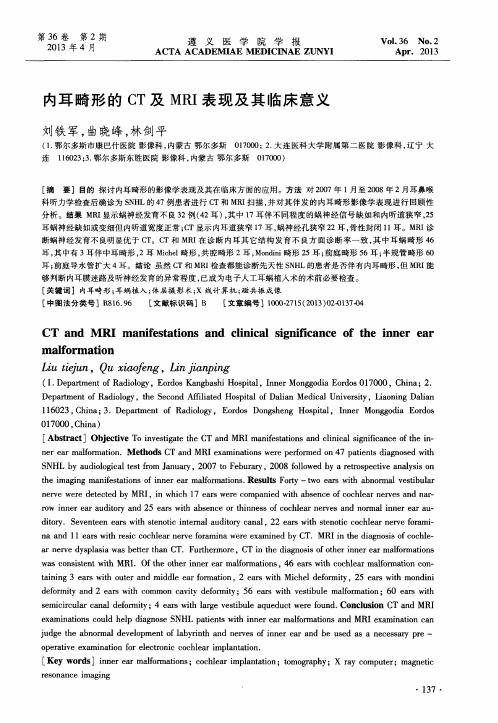 内耳畸形的CT及MRI表现及其临床意义