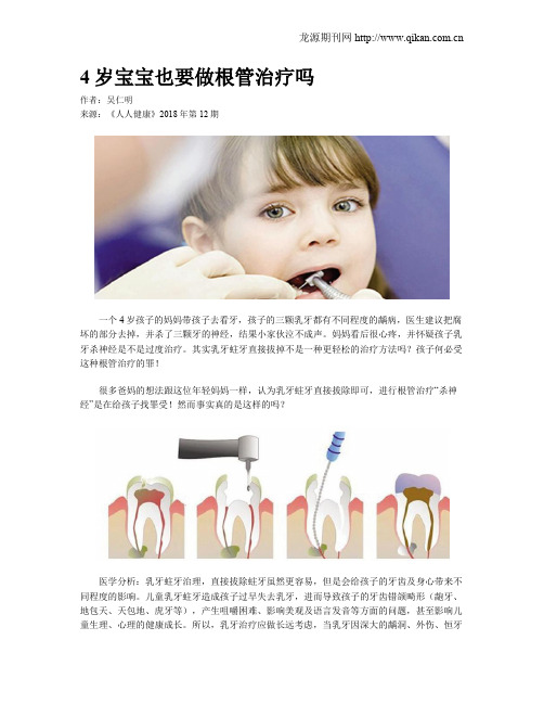 4岁宝宝也要做根管治疗吗