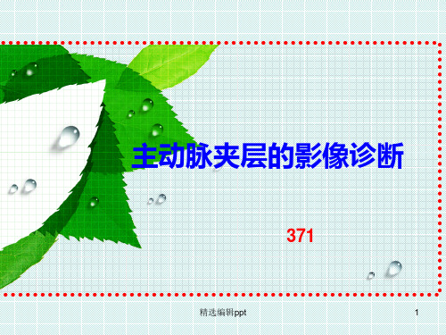 主动脉夹层的影像诊断ppt课件